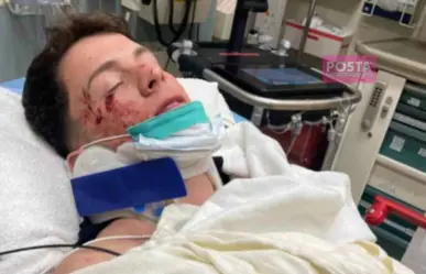 ¡Vaya choque! Guaynna sufre accidente y termina en el hospital