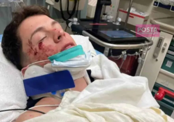 ¡Vaya choque! Guaynna sufre accidente y termina en el hospital