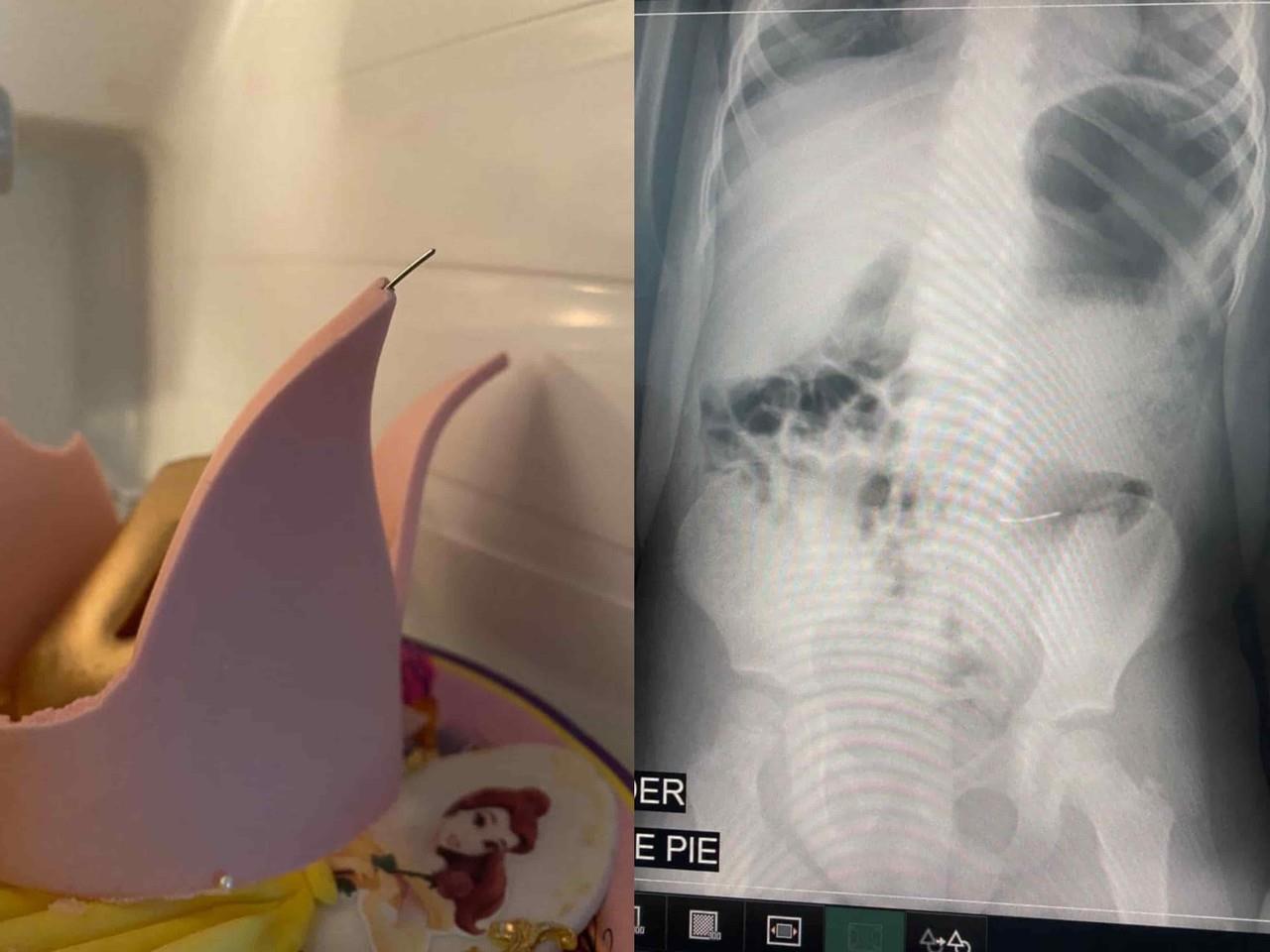 ¡Ojo! Niñas acaban en hospital por comer pastel con metal