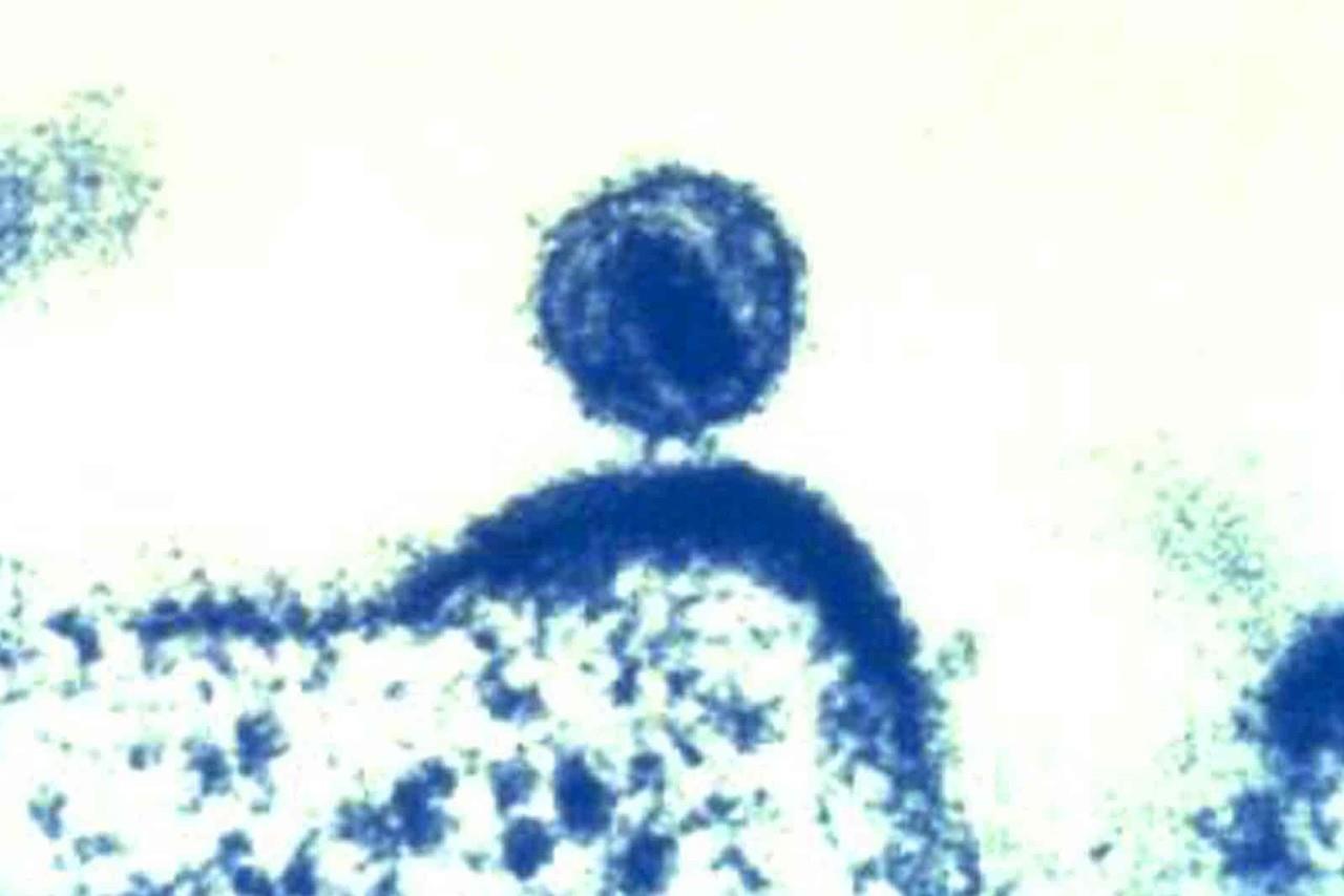 Identifican nueva variante del VIH