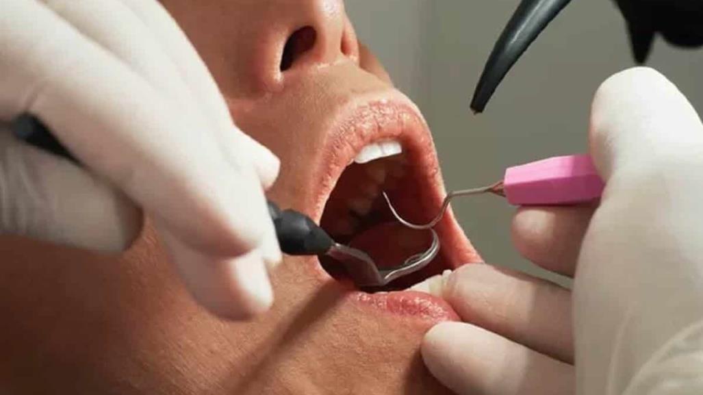 Engañaba odontólogo a pacientes; dañaba dentaduras para cobrar más dinero