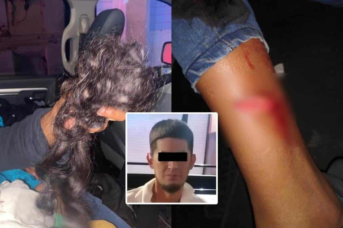 Ataca salvadoreño a dos hondureñas con machete; lesiona a la menor