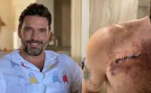 Revela Julián Gil haber sufrido cáncer de piel