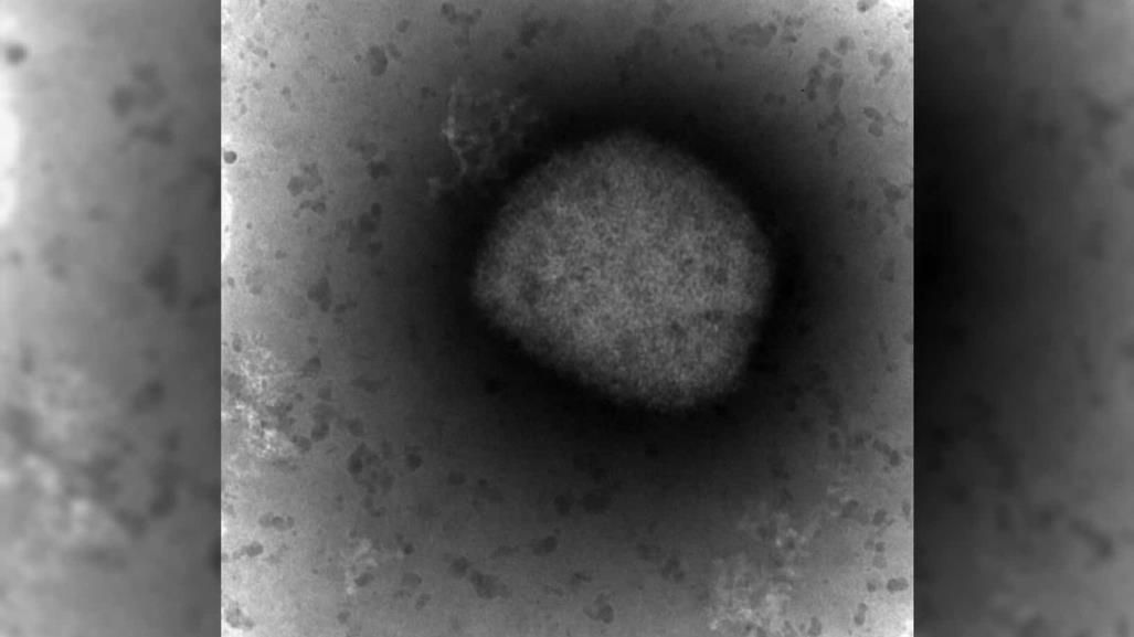 Detectan dos cepas de la viruela del mono en EU