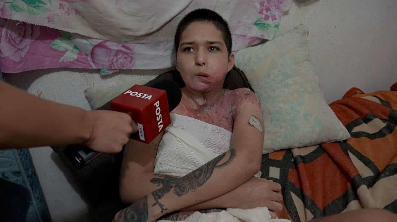 Mujer que fue quemada y violada busca salir de Nuevo León