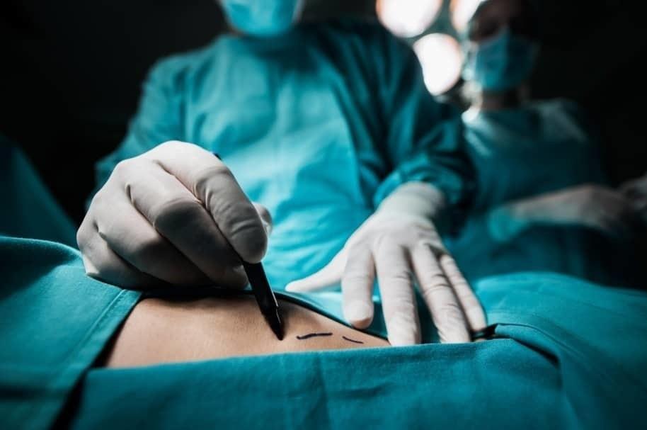 Muertes en cirugías estéticas de Tijuana alertan turismo médico de EU