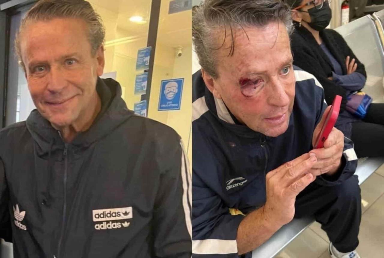 ¡Sufre Alfredo Adame brutal ataque!