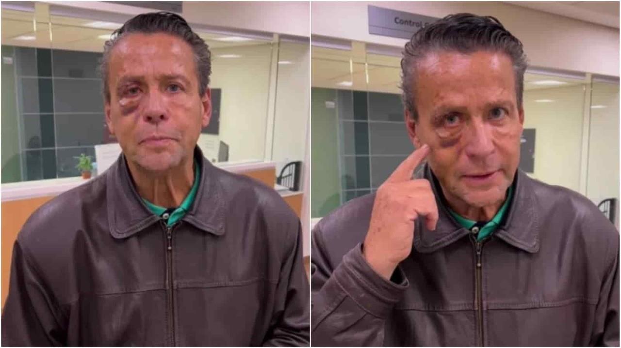 Operan a Alfredo Adame de las lesiones en el ojo derecho