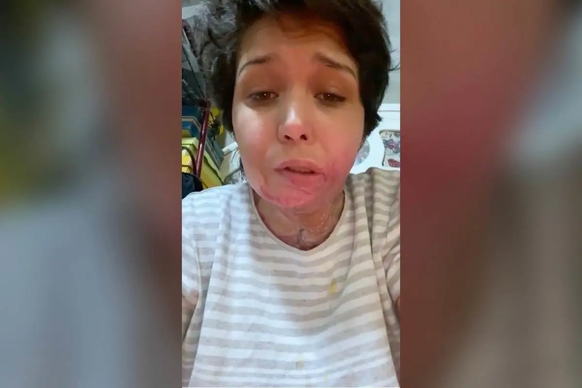 Liliana sigue sin recibir justicia; sufrió tentativa de feminicidio
