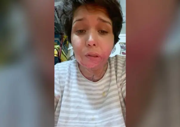 Liliana sigue sin recibir justicia; sufrió tentativa de feminicidio