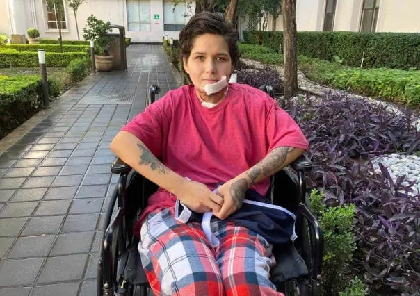 Recibe Liliana Fernández cirugía reconstructiva de su rostro