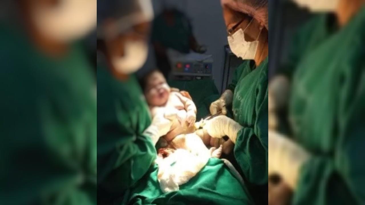 Nace bebé gigante en Brasil... ¡pesó más de siete kilos!