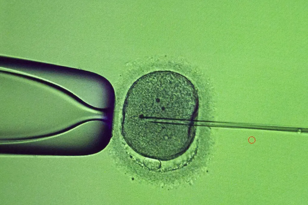 Un especialista efectúa un procedimiento de inyección intracitoplásmica de espermatozoides en el laboratorio de la clínica de fertilidad IVMED en Kiev, Ucrania, el martes 31 de enero de 2023. (AP Foto/Roman Hrytsyna)