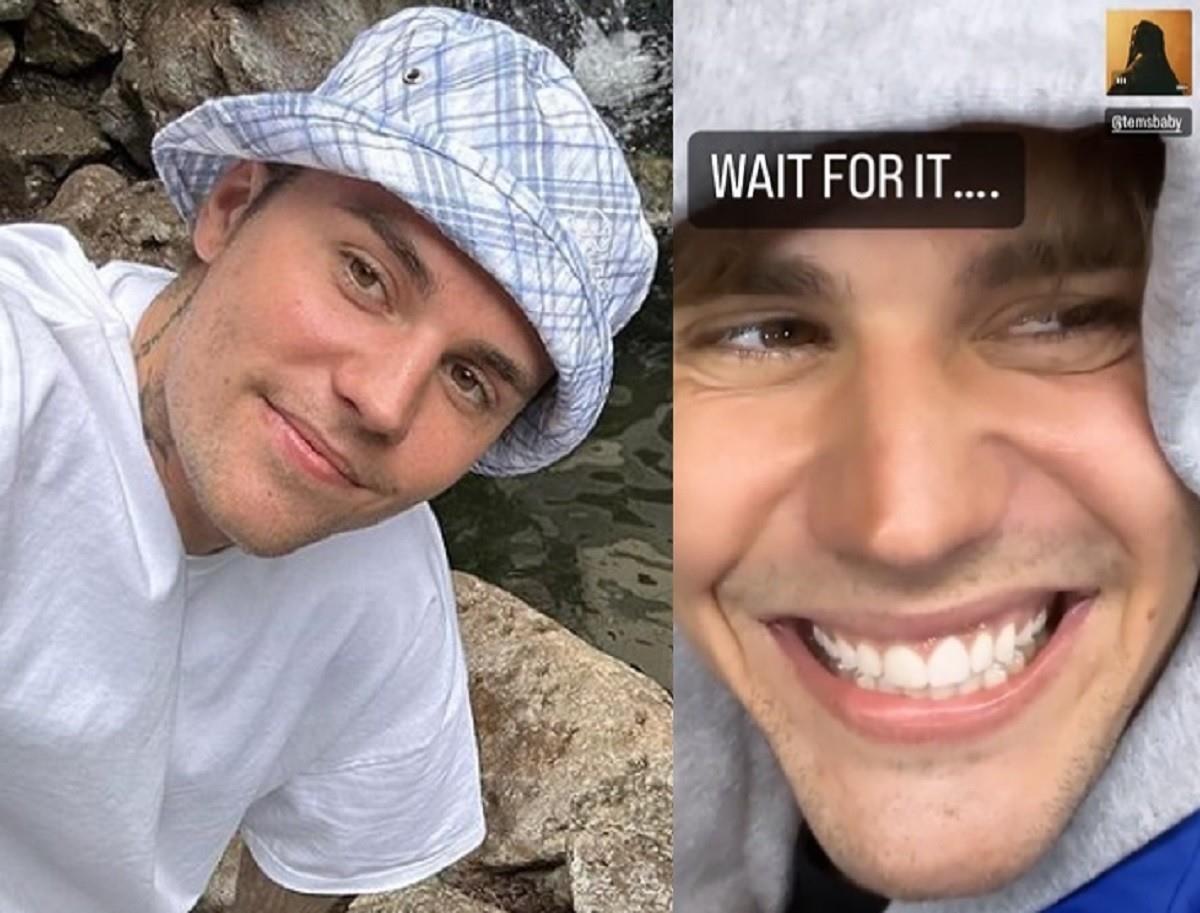 El cantante Justin Bieber recupera su sonrisa tras ser diagnosticado con el síndrome Ramsay Hunt. Foto: Instagram Justin Bieber / Twitter @sighrems