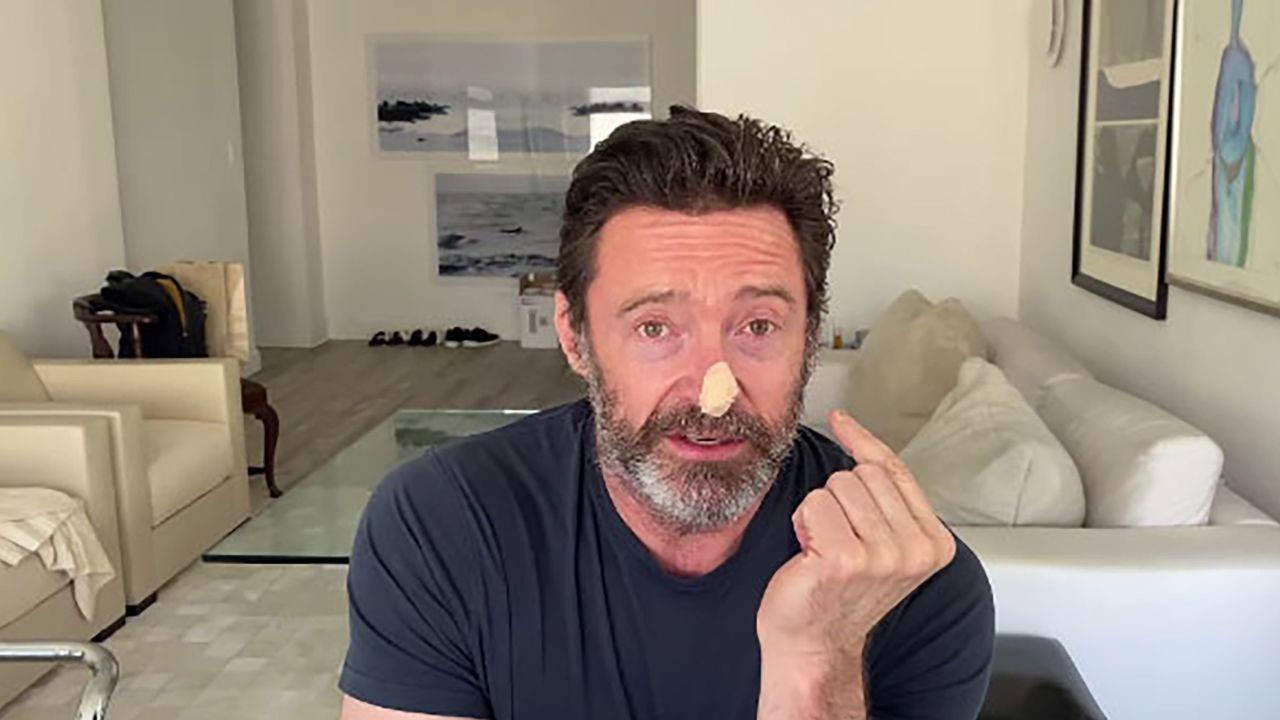 Desde el 2013, Hugh Jackman ha sufrido este tipo de carcinoma basal, por lo que ya se ha sometido a seis intervenciones. Foto. Especial