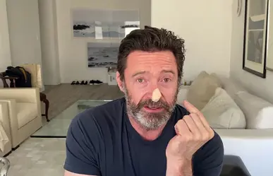 Se somete Hugh Jackman a dos biopsias ante posible cáncer de piel