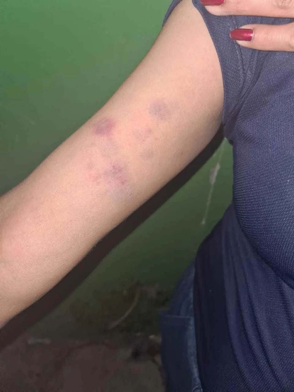 Detienen a joven por golpear e intentar ahorcar a su pareja embarazada