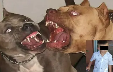 Matan perros Pitbull a niño de 4 años en Chihuahua