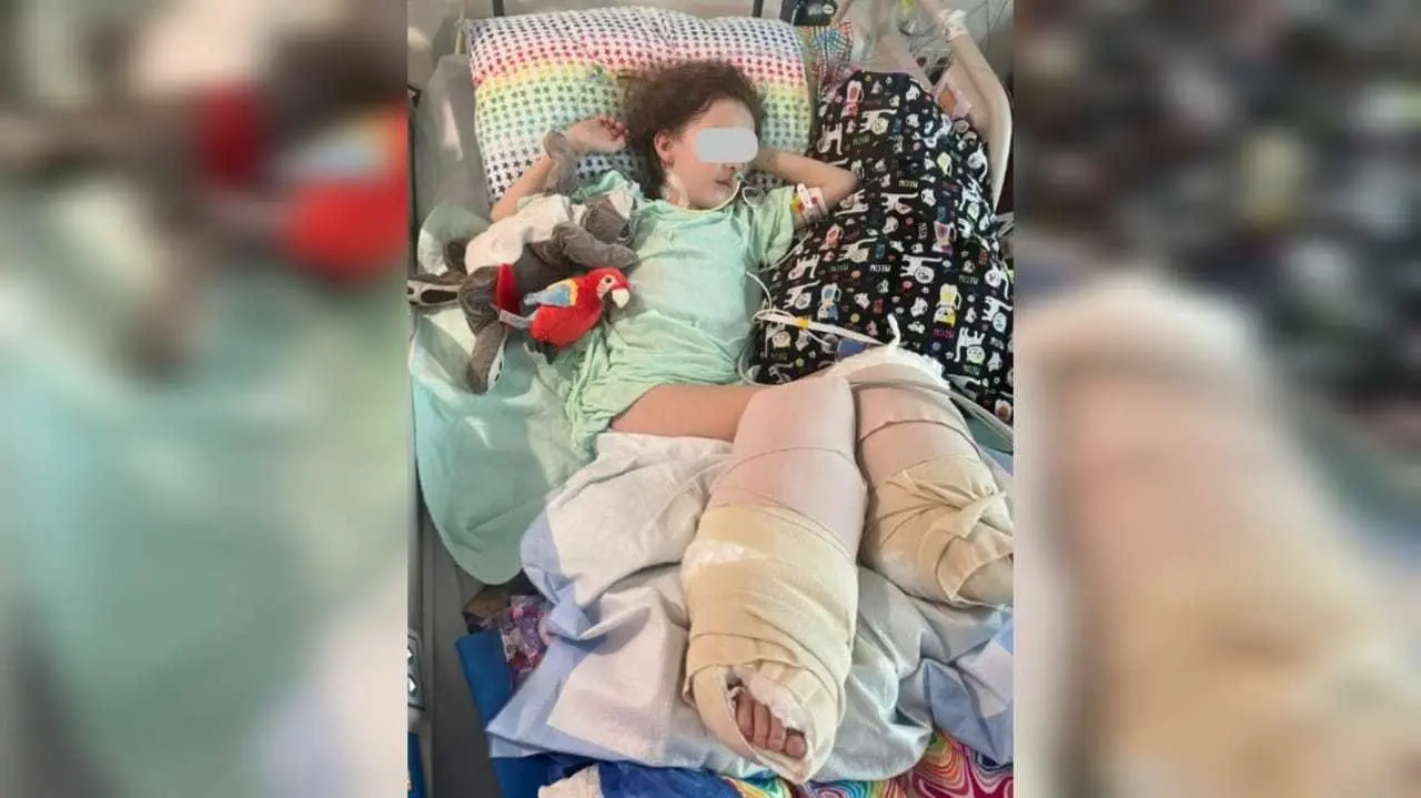 Aubrey se someterá a una cirugía de injerto de piel el 9 de junio y la familia espera que regrese a casa a fines de junio en una silla de ruedas con piernas elevadas. Foto: Especial/ Facebook/Lauren Wensel Scaletta