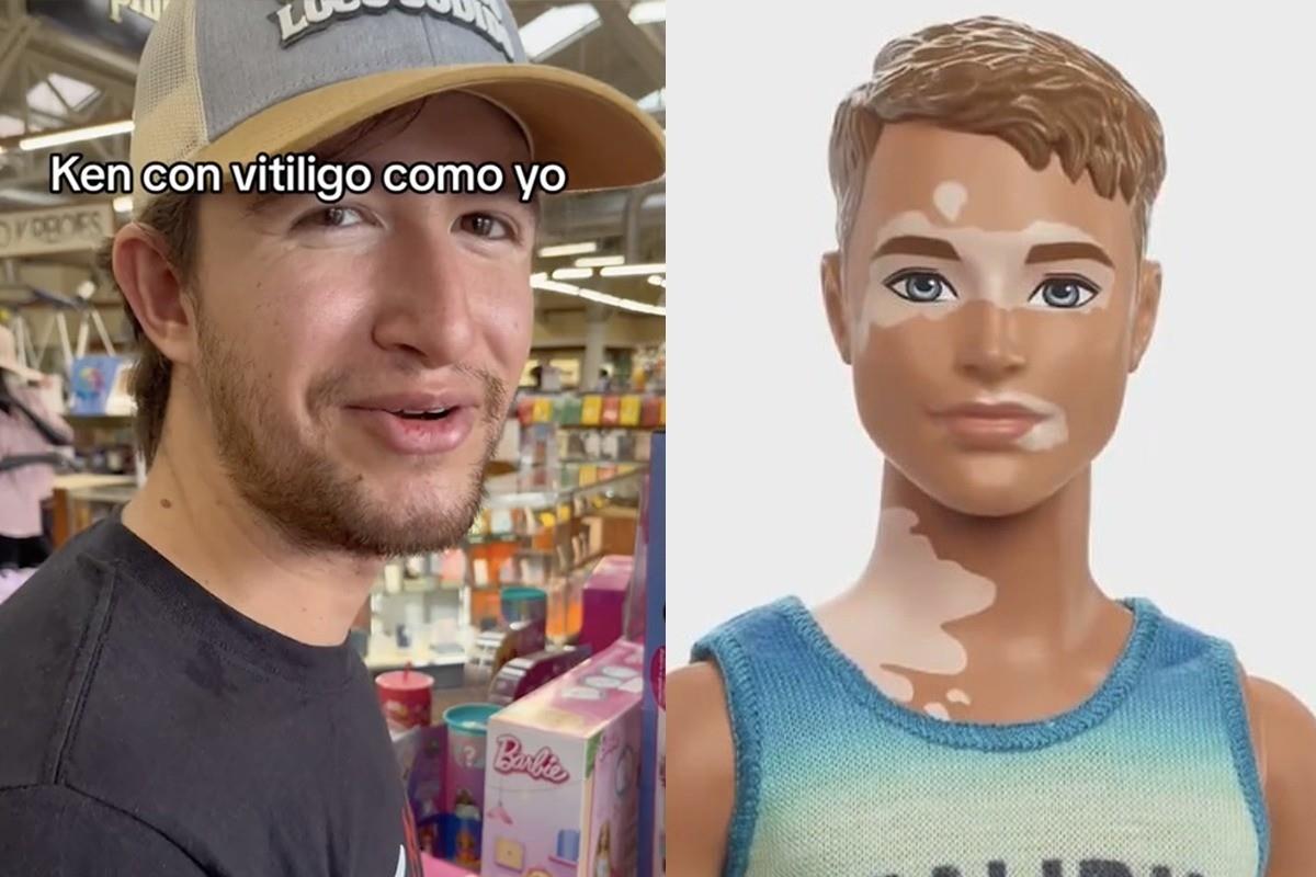 El descubrimiento de un Ken con vitiligo ha conmovido a un hombre, quien se ha sentido identificado y ha compartido su emoción en TikTok. Foto. Instagram