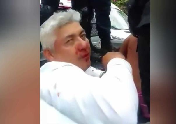 VIDEO: ¡Qué manchados! Denuncian abuso de policías de Nezahualcóyotl