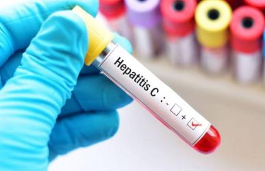 Hoy es Día Internacional de la Hepatitis C