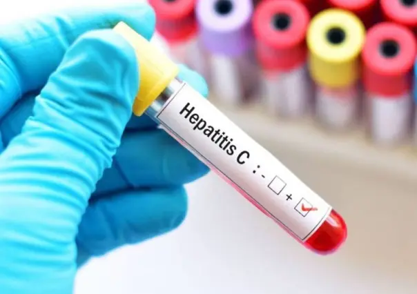 Hoy es Día Internacional de la Hepatitis C