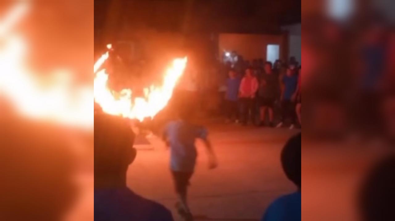 Un niño sufre quemaduras tras intentar saltar un aro de fuego durante una exhibición escolar en Argentina. Foto: Instagram diariopanoramasde