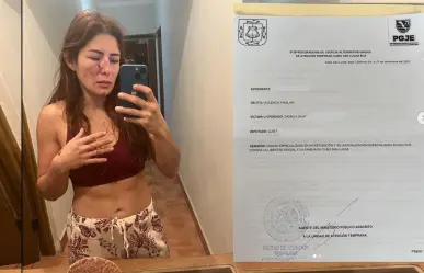 Daniela López denuncia a su expareja peleador profesional por violencia familiar