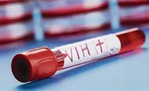 ¿Qué diferencias hay entre VIH y SIDA? Conoce su contagio y síntomas