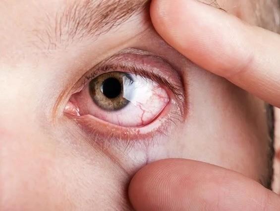 Alimentos que mejoran la vista y garantizan salud en ojos