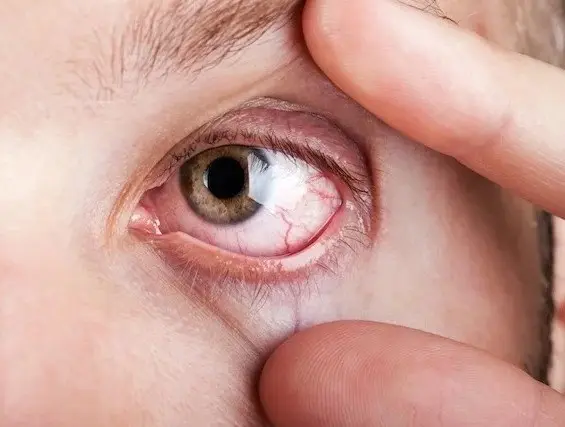 Alimentos que mejoran la vista y garantizan salud en ojos