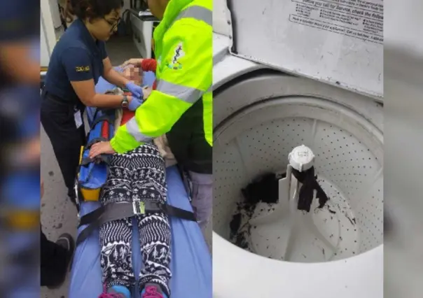 Sufre abuelita fractura de brazo al quedarse atorada en la lavadora