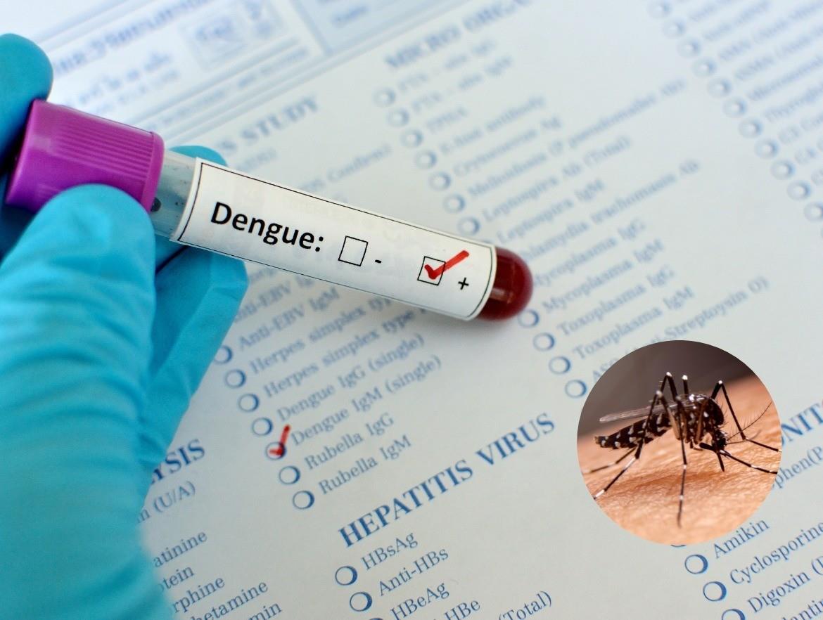 La SSA registró la cifra más baja de contagios de dengue en 4 meses Foto: Ilustrativa