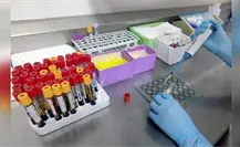 ¿Eres hombre y tienes más de 40 años? Detecta el cáncer de próstata a tiempo