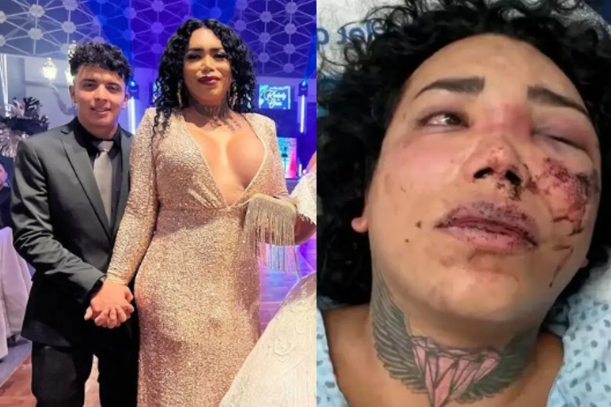 La influencer publicó varias imágenes donde su cara se ve con golpes, moretones y sangres. Foto: Instagram @paolitasuarez28/ captura de pantalla