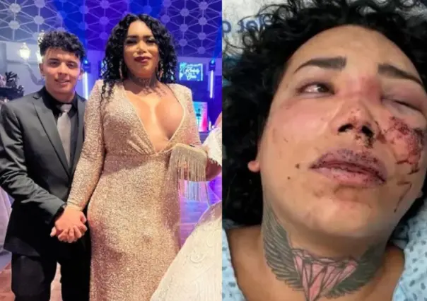 VIDEO: Paola Suárez de ‘Las Pérdidas’ fue golpeada por su prometido