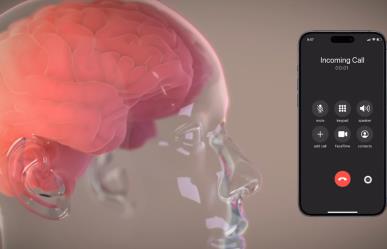 ¿Transhumanismo? Elon Musk revela que una persona ya tiene implante de Neuralink