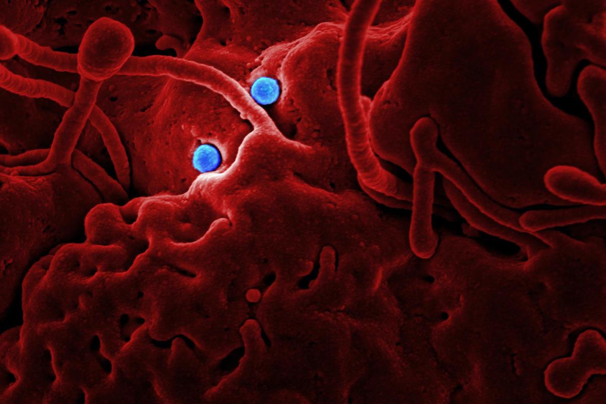 Causa 4 muertes en BCS la melioidosis, ¿sabes cómo prevenirla?