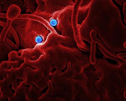 Causa 4 muertes en BCS la melioidosis, ¿sabes cómo prevenirla?