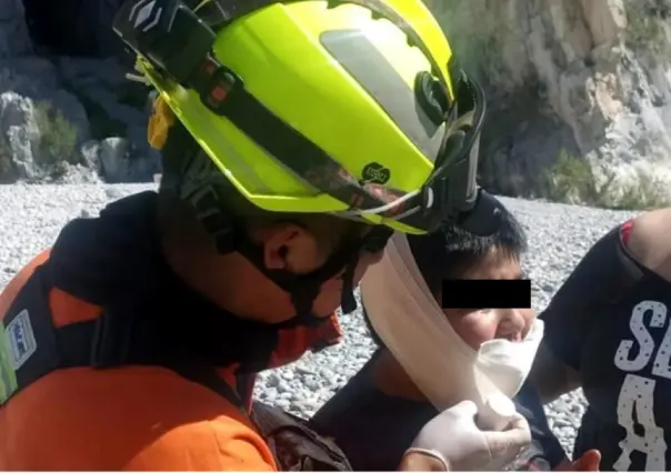 Perro ataca a niño de 10 años en Parque La Huasteca de Santa Catarina