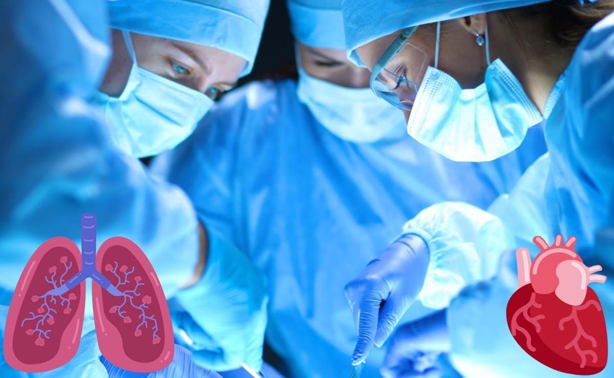 Durante el año 2023, se realizaron un total de 3,392 trasplantes en el IMSS, y en la semana siete del 2024, ya se han realizado 421 procedimientos. Foto: Foto: Mediline Plus