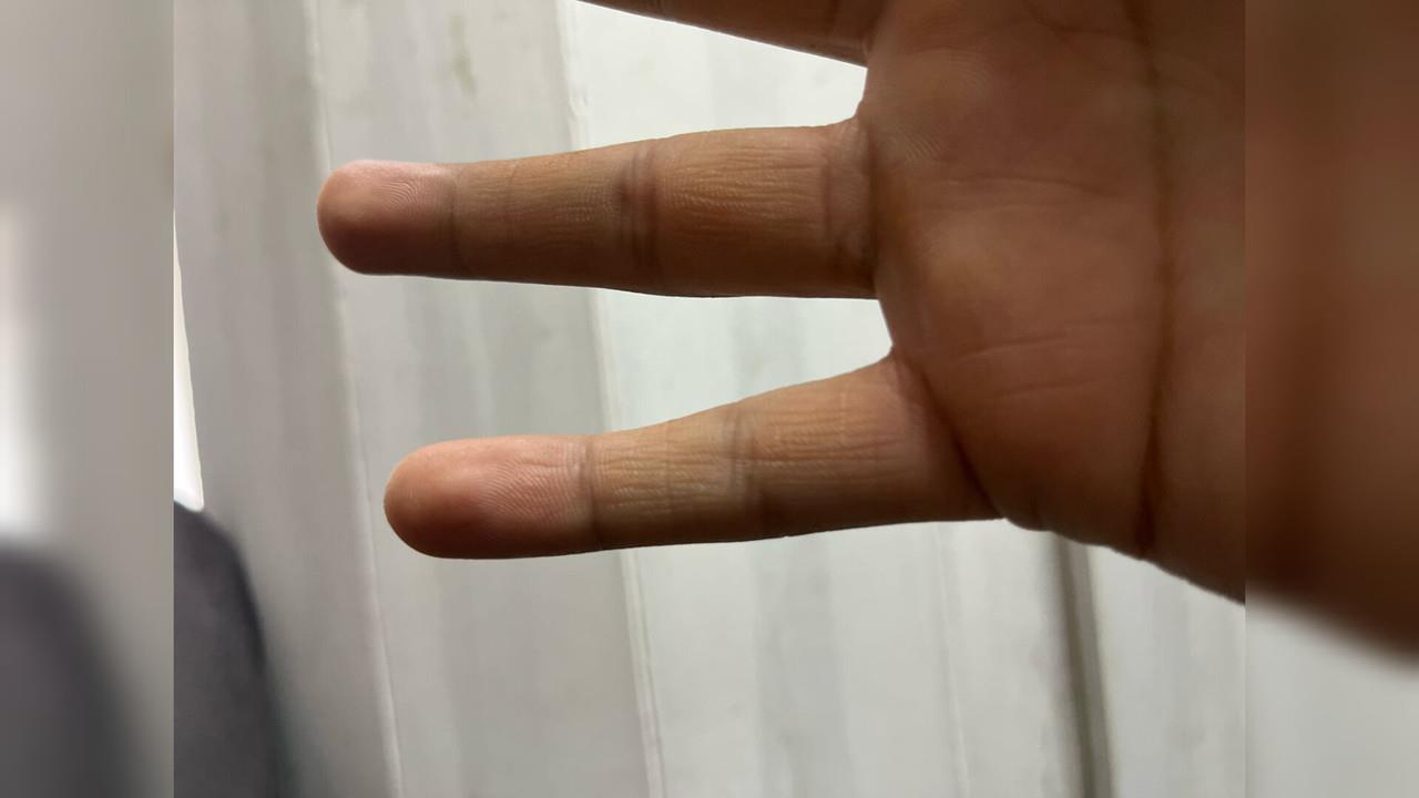 ¿Ya viste el dedo chiquito de la mano?