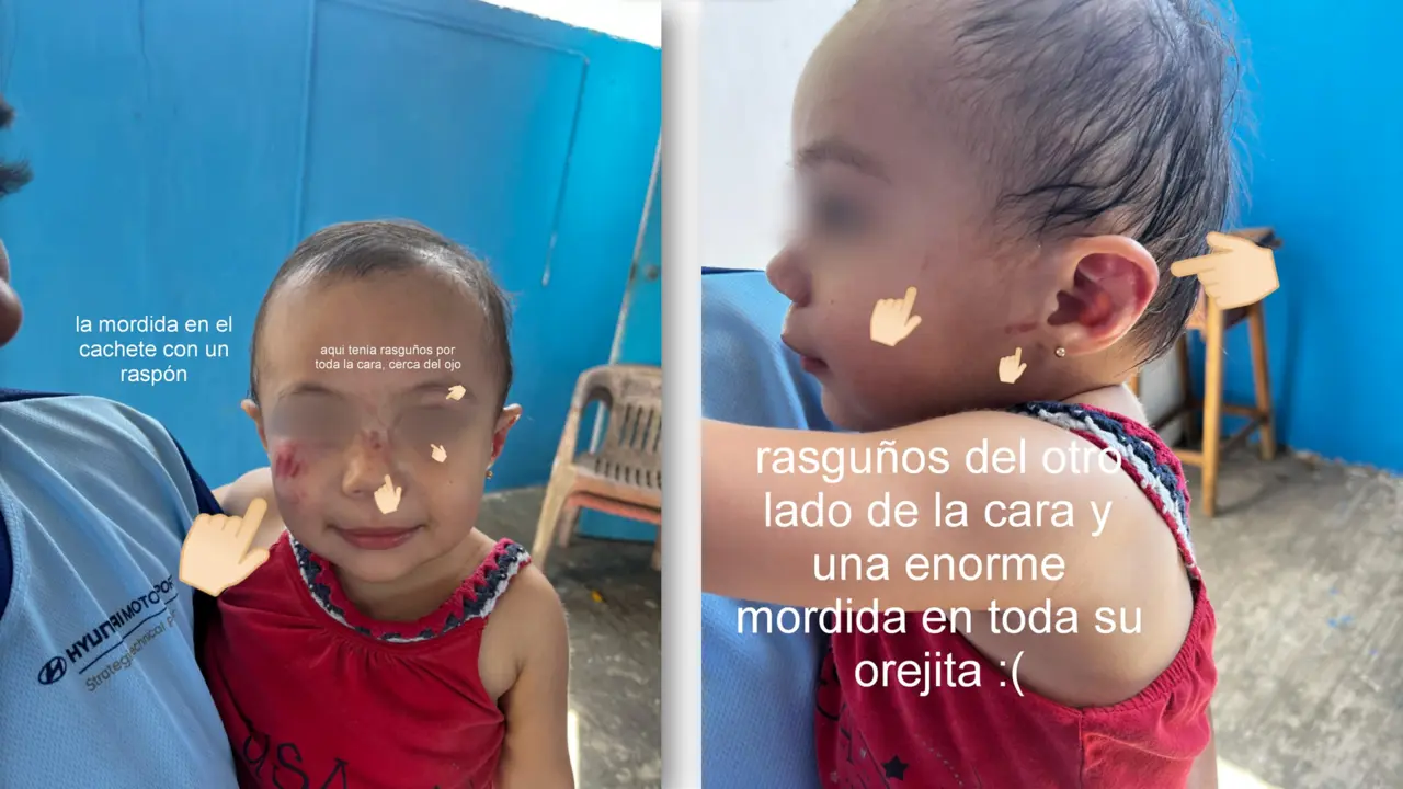 La pequeña terminó con varios golpes y mordidas Foto: Redes sociales