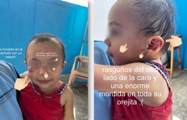 Denuncia madre preocupante agresión a su hija en estancia infantil de Mérida