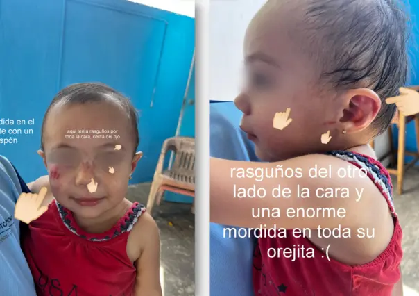 Denuncia madre preocupante agresión a su hija en estancia infantil de Mérida