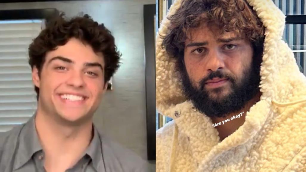 Noah Centineo chico preferido de Netflix preocupa por su apariencia