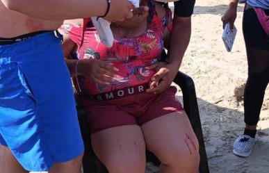 Sombrilla casi le saca el ojo a turista en Playa Miramar