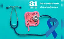 31 de marzo: Día mundial contra el cáncer de colon
