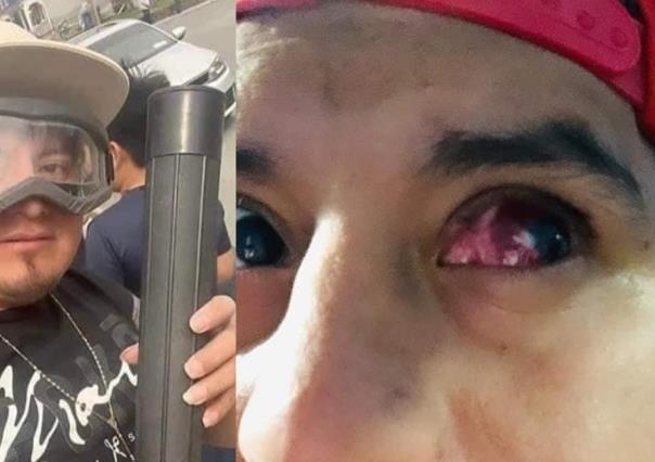 Perderá Influencer un ojo por ver el Eclipse Solar